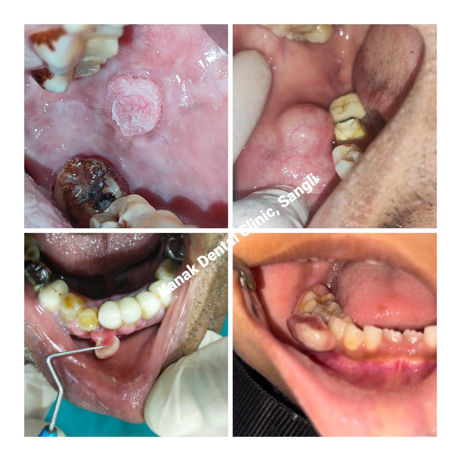 Kanak Diagnostic Centre for Oral and Maxillofacial Pathologies